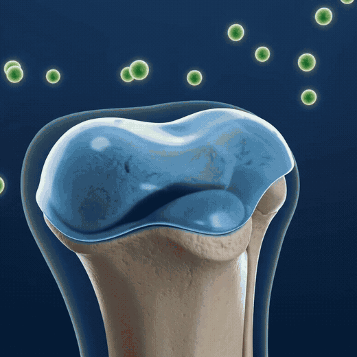Cartilage breaking down inside a joint