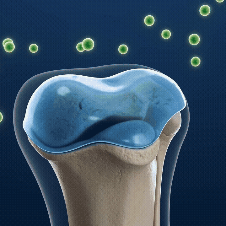 Animation of a joint whose cartilage cushion is worn away by enzymes